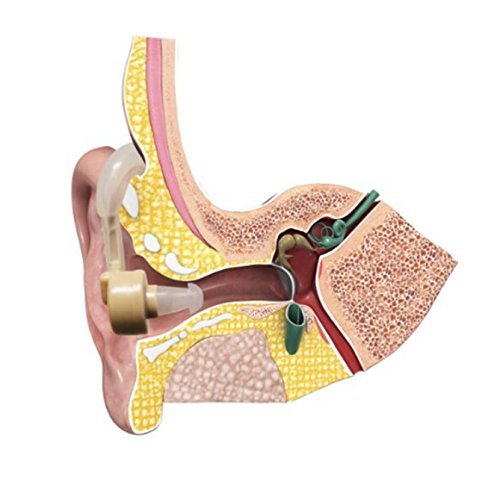 Behind The Ear Adjustable Sound Tone Deaf Aids