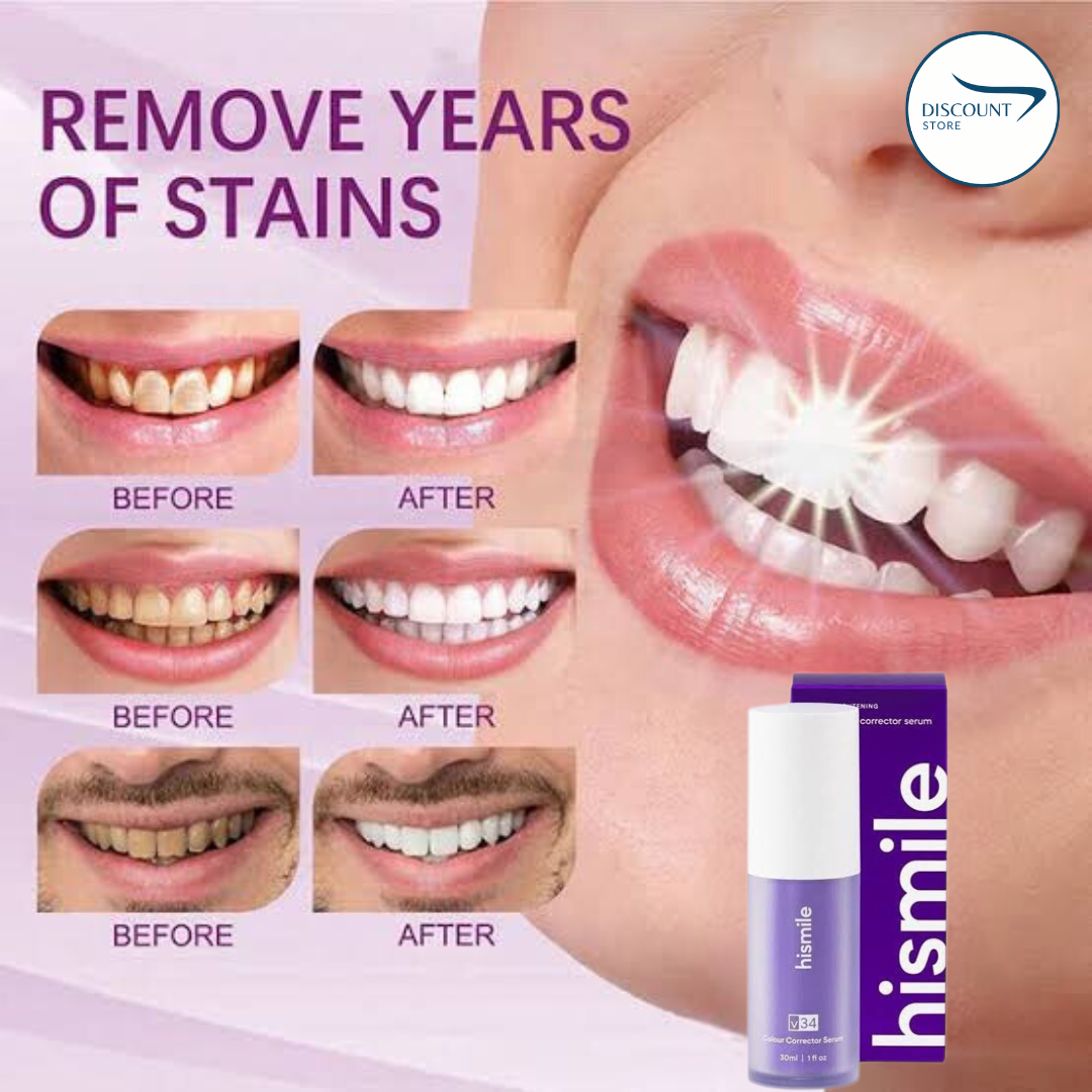 V34 Teeth Whitening Serum