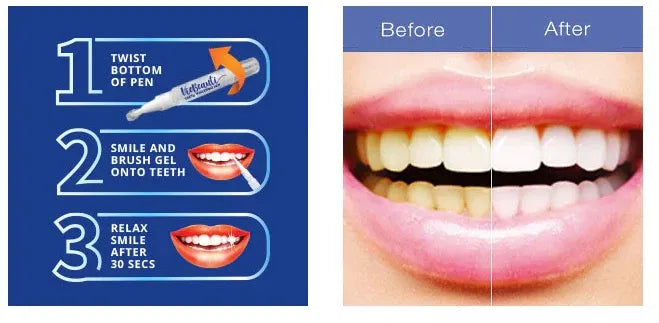 Teeth Whitening Bundle: V34 Colour Corrector Serum + Dazzling White Pen