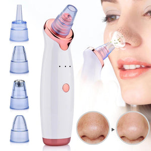 Electric USB Rechargeable Blackhead and Pore Remover
